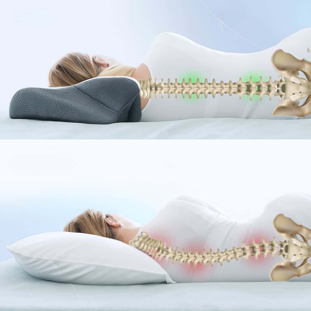 Ergonomisches Stützkissen Curolex™